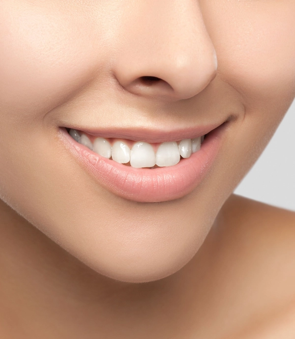 Cosmetic Tooth Contouring at Smile Hills Dental