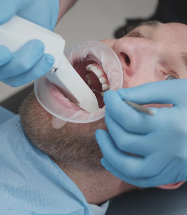 Digital Impressions at Smile Hills Dental