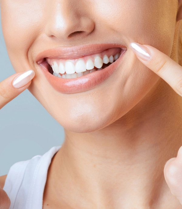 Smile Makeover at Smile Hills Dental