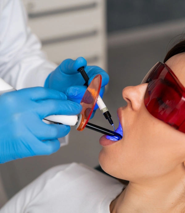 Soft Tissue Laser at Smile Hills Dental
