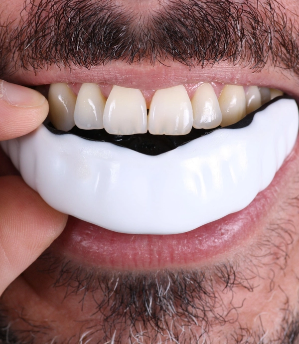 Sports Mouth Guards at Smile Hills Dental